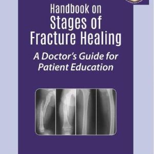 Handbook on Stages of Fracture Healing: A Doctor’s Guide for Patient Education, 2nd Edition (Original PDF from Publisher)