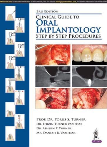 Clinical Guide to Oral Implantology: Step by Step Procedures, 3rd Edition (Original PDF from Publisher)