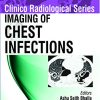 Imaging of Chest Infections (Clinico Radiological) (Original PDF from Publisher)