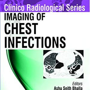 Imaging of Chest Infections (Clinico Radiological) (Original PDF from Publisher)