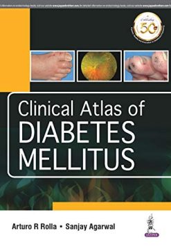Clinical Atlas of Diabetes Mellitus (Original PDF from Publisher)