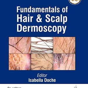 Fundamentals of Hair and Scalp Dermoscopy (Original PDF from Publisher)