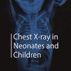 Chest X-ray in Neonates and Children (Original PDF from Publisher)