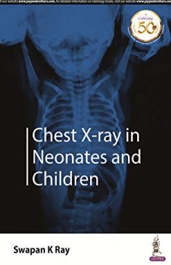 Chest X-ray in Neonates and Children (Original PDF from Publisher)