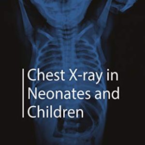 Chest X-ray in Neonates and Children (Original PDF from Publisher)