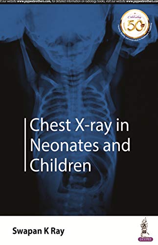 Chest X-ray in Neonates and Children (Original PDF from Publisher)