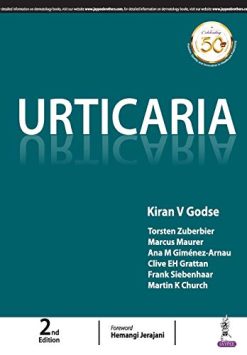 Urticaria, 2nd Edition (Original PDF from Publisher)