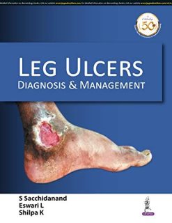 Leg Ulcers: Diagnosis and Management (Original PDF from Publisher)
