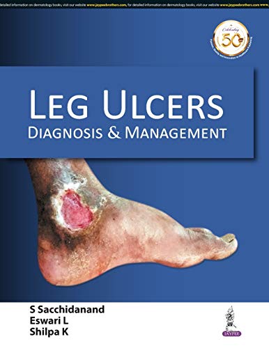 Leg Ulcers: Diagnosis and Management (Original PDF from Publisher)