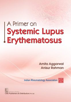 A Primer on Lupus Systematic Erythematosus (Original PDF from Publisher)