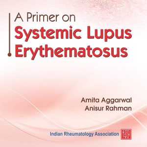 A Primer on Lupus Systematic Erythematosus (Original PDF from Publisher)