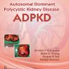 Autosomal Dominant Polytechnic Kidney Disease ADPKD (Original PDF from Publisher)