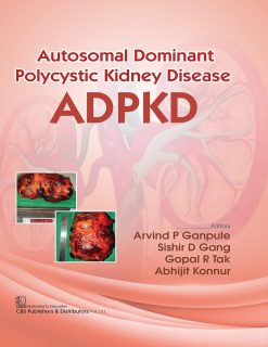 Autosomal Dominant Polytechnic Kidney Disease ADPKD (Original PDF from Publisher)