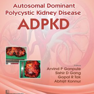 Autosomal Dominant Polytechnic Kidney Disease ADPKD (Original PDF from Publisher)