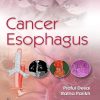 Cancer Esophagus (Original PDF from Publisher)