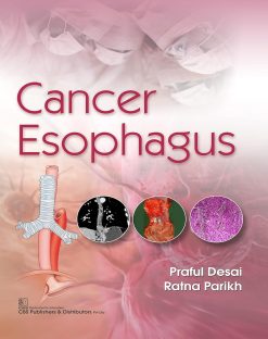 Cancer Esophagus (Original PDF from Publisher)