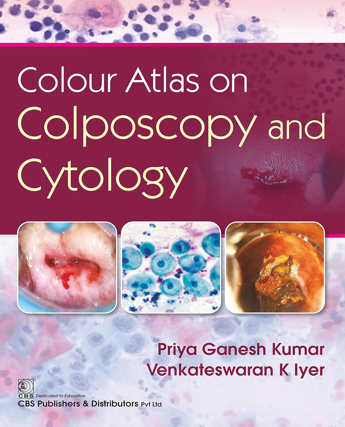 Colour Atlas on Colposcpoy and Cytology (Original PDF from Publisher)