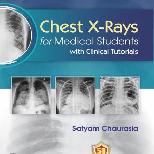 Chest X-ray for Medical Students with Clinical Tutorials (Original PDF from Publisher)