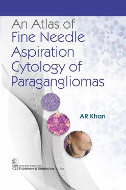An Atlas of Fine Needle Aspiration Cytology of Paragangliomas (Original PDF from Publisher)