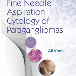 An Atlas of Fine Needle Aspiration Cytology of Paragangliomas (Original PDF from Publisher)