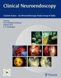 Clinical Neuroendoscopy: Current Status By Neuroendoscopy Group of India (Original PDF from Publisher)