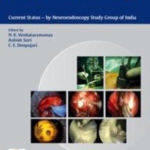 Clinical Neuroendoscopy: Current Status By Neuroendoscopy Group of India (Original PDF from Publisher)