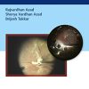Basics of Vitrectomy (Original PDF from Publisher)