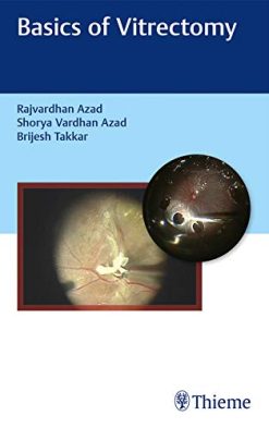 Basics of Vitrectomy (Original PDF from Publisher)