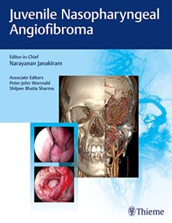 Juvenile Nasopharyngeal Angiofibroma (Original PDF from Publisher)