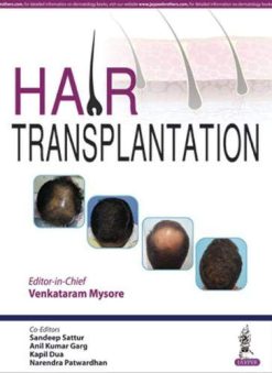 Hair Transplantation (Original PDF from Publisher)