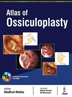 Atlas Of Ossiculoplasty (Original PDF from Publisher)