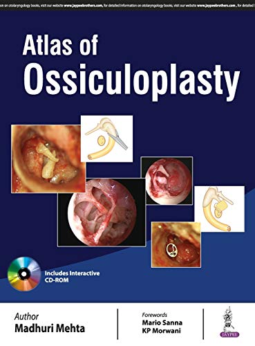 Atlas Of Ossiculoplasty (Original PDF from Publisher)