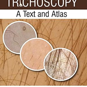 Trichoscopy: A Text and Atlas (Original PDF from Publisher)