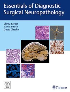 Essentials of Diagnostic Surgical Neuropathology: Care of the Adult Neurosurgical Patient (Original PDF from Publisher)