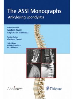 The ASSI Monographs: Ankylosing Spondylitis (Original PDF from Publisher)