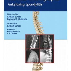 The ASSI Monographs: Ankylosing Spondylitis (Original PDF from Publisher)
