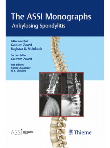 The ASSI Monographs: Ankylosing Spondylitis (Original PDF from Publisher)