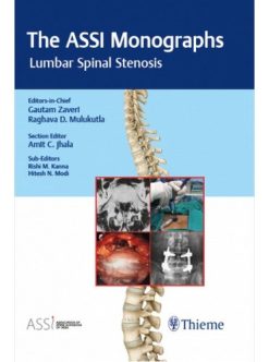 The ASSI Monographs: Lumbar Spinal Stenosis (Original PDF from Publisher)