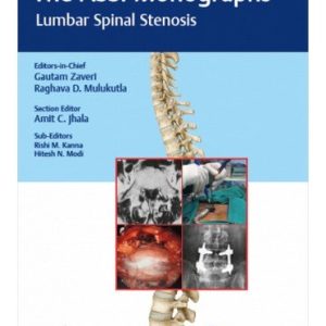 The ASSI Monographs: Lumbar Spinal Stenosis (Original PDF from Publisher)