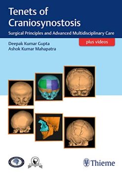 Tenets of Craniosynostosis: Surgical Principles and Advanced Multidisciplinary Care (Original PDF from Publisher+Videos)