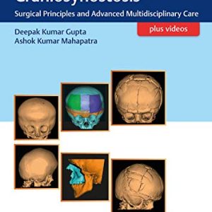 Tenets of Craniosynostosis: Surgical Principles and Advanced Multidisciplinary Care (Original PDF from Publisher+Videos)