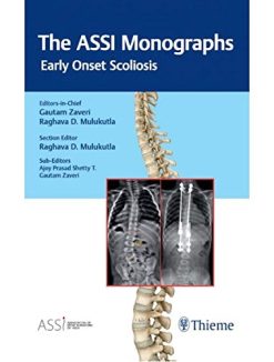The ASSI Monographs: Early Onset Scoliosis (Original PDF from Publisher)