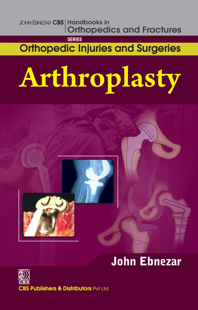 Arthroplasty (EPUB)