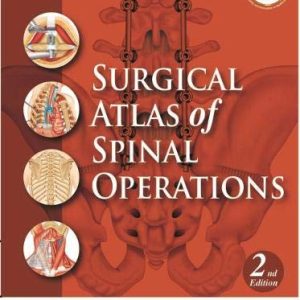 Surgical Atlas of Spinal Operations, 2nd Edition (Original PDF from Publisher)