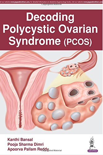 Decoding Polycystic Ovarian Syndrome (PCOS) (Original PDF from Publisher)