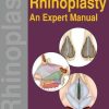 Rhinoplasty: An Expert Manual (Original PDF from Publisher)