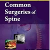 Common Surgeries of Spine (EPUB)