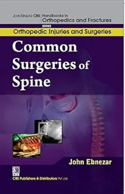 Common Surgeries of Spine (EPUB)