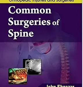 Common Surgeries of Spine (EPUB)
