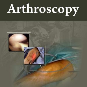 Arthroscopy (EPUB)